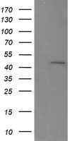 RNF39 Antibody - HEK293T cells were transfected with the pCMV6-ENTRY control (Left lane) or pCMV6-ENTRY RNF39 (Right lane) cDNA for 48 hrs and lysed. Equivalent amounts of cell lysates (5 ug per lane) were separated by SDS-PAGE and immunoblotted with anti-RNF39.