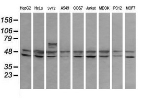 RNF39 Antibody - Western blot of extracts (35 ug) from 9 different cell lines by using g anti-RNF39 monoclonal antibody (HepG2: human; HeLa: human; SVT2: mouse; A549: human; COS7: monkey; Jurkat: human; MDCK: canine; PC12: rat; MCF7: human).