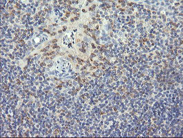 RNF39 Antibody - IHC of paraffin-embedded Human tonsil using anti-RNF39 mouse monoclonal antibody.