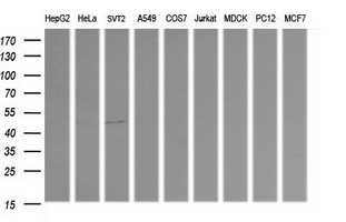 RNF39 Antibody - Western blot of extracts (35ug) from 9 different cell lines by using anti-RNF39 monoclonal antibody (HepG2: human; HeLa: human; SVT2: mouse; A549: human; COS7: monkey; Jurkat: human; MDCK: canine; PC12: rat; MCF7: human).