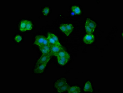 RNF39 Antibody - Immunofluorescence staining of HepG2 cells at a dilution of 1:133, counter-stained with DAPI. The cells were fixed in 4% formaldehyde, permeabilized using 0.2% Triton X-100 and blocked in 10% normal Goat Serum. The cells were then incubated with the antibody overnight at 4 °C.The secondary antibody was Alexa Fluor 488-congugated AffiniPure Goat Anti-Rabbit IgG (H+L) .