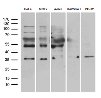 RNF4 Antibody - Western blot analysis of extracts. (35ug) from 5 different cell lines by using anti-RNF4 monoclonal antibody. (1:500)