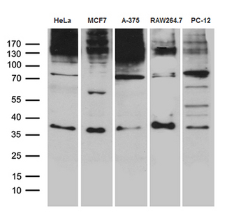 RNF4 Antibody - Western blot analysis of extracts. (35ug) from 5 different cell lines by using anti-RNF4 monoclonal antibody. (1:500)