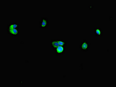 RNF4 Antibody - Immunofluorescent analysis of HepG2 cells diluted at 1:100 and Alexa Fluor 488-congugated AffiniPure Goat Anti-Rabbit IgG(H+L)