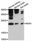 RNF4 Antibody - Western blot analysis of extracts of various cell lines, using RNF4 antibody at 1:3000 dilution. The secondary antibody used was an HRP Goat Anti-Rabbit IgG (H+L) at 1:10000 dilution. Lysates were loaded 25ug per lane and 3% nonfat dry milk in TBST was used for blocking. An ECL Kit was used for detection and the exposure time was 90s.