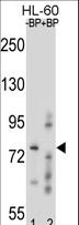 RNF40 / STARING Antibody - Western blot of RNF40 Antibody antibody pre-incubated without(lane 1) and with(lane 2) blocking peptide in HL-60 cell line lysate. RNF40 Antibody (arrow) was detected using the purified antibody.
