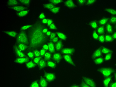 RNF40 / STARING Antibody - Immunofluorescence analysis of MCF-7 cells.