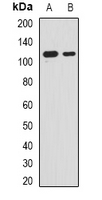 RNF40 / STARING Antibody - Western blot analysis of RNF40 expression in MCF7 (A); HepG2 (B) whole cell lysates.