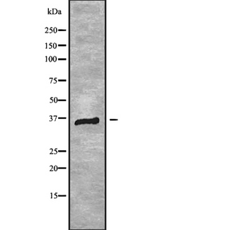 RNF41 Antibody - Western blot analysis of RNF41 using HeLa whole cells lysates