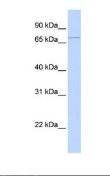 RNF6 Antibody - 293T cell lysate. Antibody concentration: 1.0 ug/ml. Gel concentration: 12%.  This image was taken for the unconjugated form of this product. Other forms have not been tested.