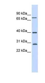 RNF6 Antibody - RNF6 antibody Western blot of Fetal Spleen lysate. This image was taken for the unconjugated form of this product. Other forms have not been tested.