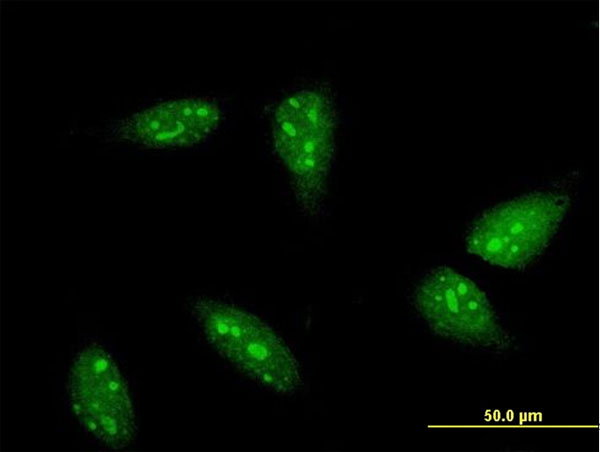 RNF6 Antibody - Immunofluorescence of monoclonal antibody to RNF6 on HeLa cell . [antibody concentration 10 ug/ml]