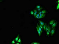 RNF6 Antibody - Immunofluorescent analysis of HepG2 cells diluted at 1:100 and Alexa Fluor 488-congugated AffiniPure Goat Anti-Rabbit IgG(H+L)