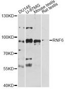 RNF6 Antibody - Western blot analysis of extracts of various cell lines, using RNF6 antibody at 1:1000 dilution. The secondary antibody used was an HRP Goat Anti-Rabbit IgG (H+L) at 1:10000 dilution. Lysates were loaded 25ug per lane and 3% nonfat dry milk in TBST was used for blocking. An ECL Kit was used for detection and the exposure time was 90s.
