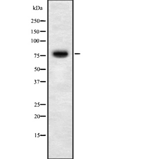 RNF6 Antibody - Western blot analysis of RNF6 using MCF-7 whole cells lysates