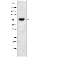 RNF6 Antibody - Western blot analysis of RNF6 using MCF-7 whole cells lysates