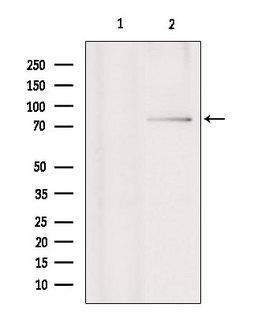 RNF6 Antibody - Western blot analysis of extracts of various samples using RNF6 antibody. Lane 1: HeLa treated with blocking peptide. Lane 2: HeLa; Lane 3: HepG2;