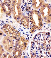 RNF7 Antibody - Antibody staining RNF7 in human kidney tissue sections by Immunohistochemistry (IHC-P - paraformaldehyde-fixed, paraffin-embedded sections). Tissue was fixed with formaldehyde and blocked with 3% BSA for 0. 5 hour at room temperature; antigen retrieval was by heat mediation with a citrate buffer (pH 6). Samples were incubated with primary antibody (1:25) for 1 hours at 37°C. A undiluted biotinylated goat polyvalent antibody was used as the secondary antibody.