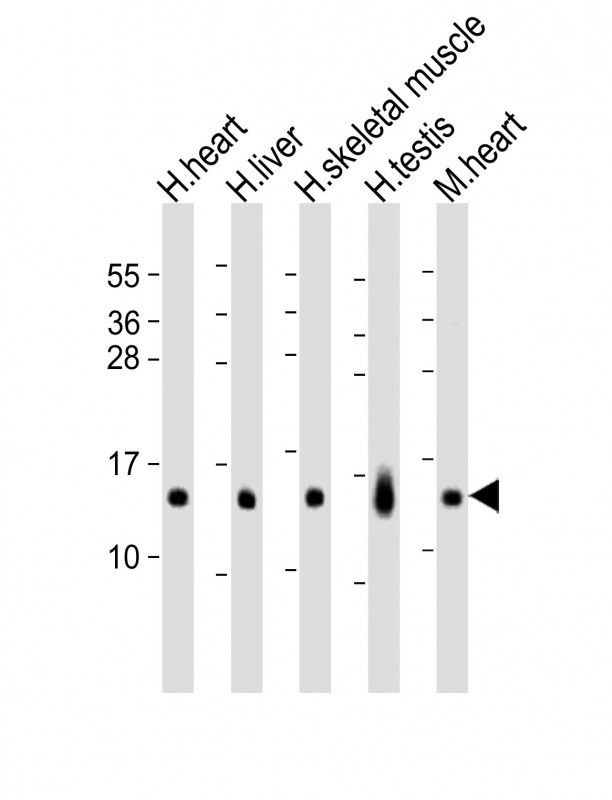 RNF7 Antibody - All lanes: Anti-RNF7 Antibody (N-term) at 1:8000 dilution. Lane 1: human heart lysates. Lane 2: human liver lysates. Lane 3: human skeletal muscle lysates. Lane 4: human testis lysates. Lane 5: mouse heart lysates Lysates/proteins at 20 ug per lane. Secondary Goat Anti-Rabbit IgG, (H+L), Peroxidase conjugated at 1:10000 dilution. Predicted band size: 13 kDa. Blocking/Dilution buffer: 5% NFDM/TBST.