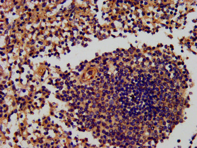 RNF7 Antibody - IHC image of RNF7 Antibody diluted at 1:600 and staining in paraffin-embedded human spleen tissue performed on a Leica BondTM system. After dewaxing and hydration, antigen retrieval was mediated by high pressure in a citrate buffer (pH 6.0). Section was blocked with 10% normal goat serum 30min at RT. Then primary antibody (1% BSA) was incubated at 4°C overnight. The primary is detected by a biotinylated secondary antibody and visualized using an HRP conjugated SP system.