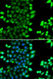 RNF7 Antibody - Immunofluorescence analysis of MCF7 cells.