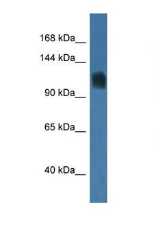 RNF74 / RAG1 Antibody - RAG1 antibody Western blot of Mouse Liver lysate. Antibody concentration 1 ug/ml. This image was taken for the unconjugated form of this product. Other forms have not been tested.