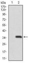 RNF74 / RAG1 Antibody - RAG1 Antibody in Western Blot (WB)