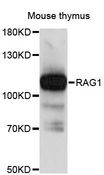RNF74 / RAG1 Antibody - Western blot analysis of extracts of mouse thymus, using RAG1 antibody at 1:3000 dilution. The secondary antibody used was an HRP Goat Anti-Rabbit IgG (H+L) at 1:10000 dilution. Lysates were loaded 25ug per lane and 3% nonfat dry milk in TBST was used for blocking. An ECL Kit was used for detection and the exposure time was 90s.