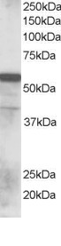 RNF8 Antibody - Antibody staining (0.1 ug/ml) of Human Lung lysate (RIPA buffer, 35 ug total protein per lane). Primary incubated for 1 hour. Detected by Western blot of chemiluminescence.