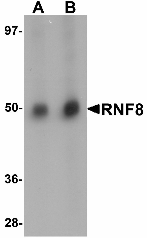 RNF8 Antibody - Western blot of RNF8 in human lung tissue lysate with RNF8 antibody at (A) and (B) 2 ug/ml.