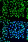 RNF8 Antibody - Immunofluorescence analysis of MCF-7 cells using RNF8 Polyclonal Antibody.