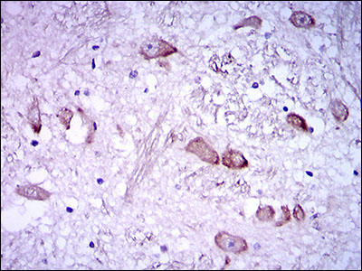rnfH Antibody - IHC of paraffin-embedded medulla oblongata tissues using NEFH mouse monoclonal antibody with DAB staining.