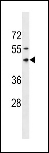 RNFT1 Antibody - RNFT1 Antibody western blot of MDA-MB231 cell line lysates (35 ug/lane). The RNFT1 antibody detected the RNFT1 protein (arrow).