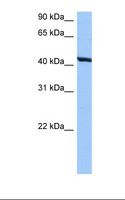 RNFT2 / TMEM118 Antibody - HepG2 cell lysate. Antibody concentration: 0.5 ug/ml. Gel concentration: 12%.  This image was taken for the unconjugated form of this product. Other forms have not been tested.