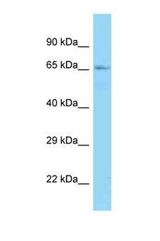 RNGTT / HCAP Antibody - RNGTT / HCE antibody Western blot of Mouse Heart lysate. Antibody concentration 1 ug/ml.  This image was taken for the unconjugated form of this product. Other forms have not been tested.