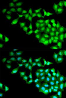 RNGTT / HCAP Antibody - Immunofluorescence analysis of MCF-7 cells.