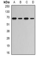 RNGTT / HCAP Antibody - Western blot analysis of RNGTT expression in Jurkat (A); HeLa (B); mouse spleen (C); rat kidney (D) whole cell lysates.