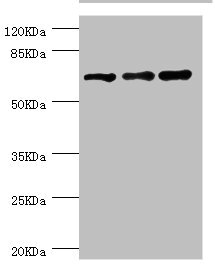 RNGTT / HCAP Antibody - Western blot All Lanes:RNGTT antibody at 1.42ug/ml Lane 1:MCF-7 whole cell lysate Lane 2:THP-1 whole cell lysate Lane 3:Hela whole cell lysate Secondary Goat polyclonal to rabbit at 1/10000 dilution Predicted band size: 69,67,53,62 kDa Observed band size: 69 kDa