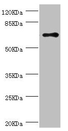 RNGTT / HCAP Antibody - Western blot All lanes: RNGTT antibody at 1.42µg/ml + THP-1 whole cell lysate Secondary Goat polyclonal to rabbit IgG at 1/10000 dilution Predicted band size: 69, 67, 53, 62 kDa Observed band size: 69 kDa