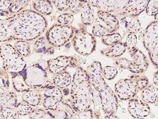 RNGTT / HCAP Antibody - Immunochemical staining of human RNGTT in human placenta with rabbit polyclonal antibody at 1:100 dilution, formalin-fixed paraffin embedded sections.