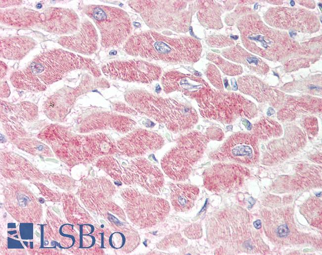 RNH1 Antibody - Human Heart: Formalin-Fixed, Paraffin-Embedded (FFPE).  This image was taken for the unconjugated form of this product. Other forms have not been tested.