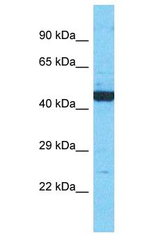 RNH1 Antibody - RNH1 antibody Western Blot of MCF7 cell lysate. Antibody dilution: 1 ug/ml.  This image was taken for the unconjugated form of this product. Other forms have not been tested.