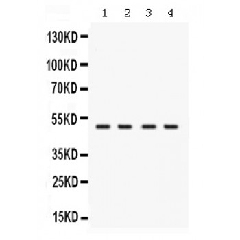 RNH1 Antibody - Western blot analysis of RNH1 expression in rat testis extract (lane 1), mouse brain extract (lane 2), human placenta extract (lane 2) and K562 whole cell lysates (lane 4). RNH1 at 50 kD was detected using rabbit anti- RNH1 Antigen Affinity purified polyclonal antibody at 0.5 ug/mL. The blot was developed using chemiluminescence (ECL) method.