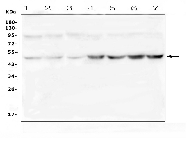 RNH1 Antibody - Western blot analysis of RNH1 using anti-RNH1 antibody. Electrophoresis was performed on a 5-20% SDS-PAGE gel at 70V (Stacking gel) / 90V (Resolving gel) for 2-3 hours. The sample well of each lane was loaded with 50ug of sample under reducing conditions. Lane 1: rat testicular tissue lysates, Lane 2: rat lung tissue lysates, Lane 3: mouse ovarian tissue lysates, Lane 4: mouse testicular tissue lysates, Lane 5: mouse lung tissue lysates, Lane 6: mouse HEPA1-6 whole cell lysates. After Electrophoresis, proteins were transferred to a Nitrocellulose membrane at 150mA for 50-90 minutes. Blocked the membrane with 5% Non-fat Milk/ TBS for 1.5 hour at RT. The membrane was incubated with rabbit anti-RNH1 antigen affinity purified polyclonal antibody at 0.5 µg/mL overnight at 4°C, then washed with TBS-0.1% Tween 3 times with 5 minutes each and probed with a goat anti-rabbit IgG-HRP secondary antibody at a dilution of 1:10000 for 1.5 hour at RT. The signal is developed using an Enhanced Chemiluminescent detection (ECL) kit with Tanon 5200 system. A specific band was detected for RNH1 at approximately 50KD. The expected band size for RNH1 is at 50KD.