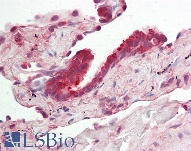 RNH1 Antibody - Human Lung: Formalin-Fixed, Paraffin-Embedded (FFPE).  This image was taken for the unconjugated form of this product. Other forms have not been tested.