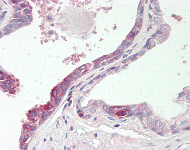 RNH1 Antibody - Human Prostate: Formalin-Fixed, Paraffin-Embedded (FFPE).  This image was taken for the unconjugated form of this product. Other forms have not been tested.