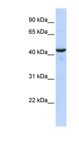 RNH1 Antibody - RNH1 antibody Western blot of Fetal Muscle lysate. This image was taken for the unconjugated form of this product. Other forms have not been tested.