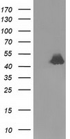 RNH1 Antibody - HEK293T cells were transfected with the pCMV6-ENTRY control (Left lane) or pCMV6-ENTRY RNH1 (Right lane) cDNA for 48 hrs and lysed. Equivalent amounts of cell lysates (5 ug per lane) were separated by SDS-PAGE and immunoblotted with anti-RNH1.