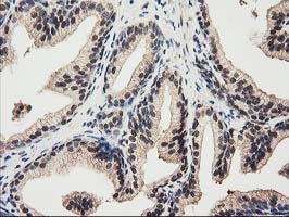 RNH1 Antibody - IHC of paraffin-embedded Human prostate tissue using anti-RNH1 mouse monoclonal antibody.