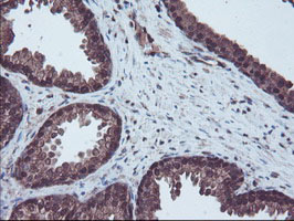 RNH1 Antibody - IHC of paraffin-embedded Human prostate tissue using anti-RNH1 mouse monoclonal antibody.